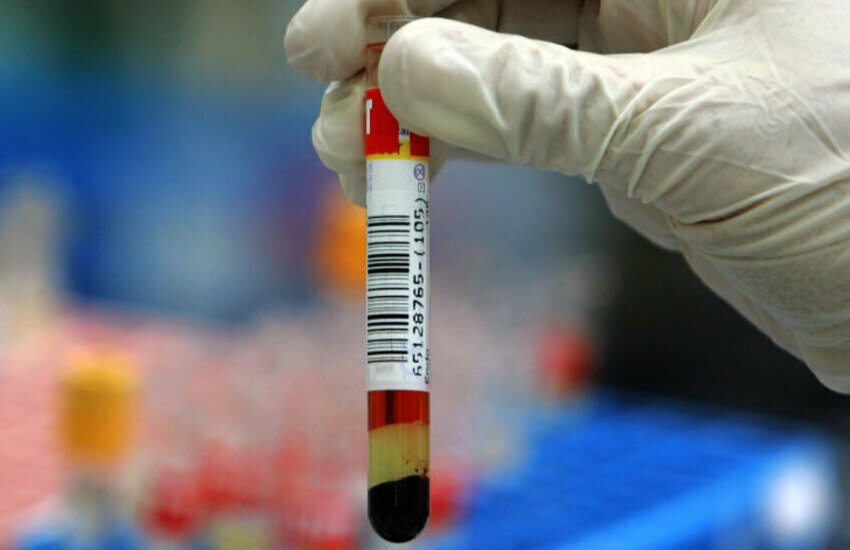Coronavirus, spunta un nuovo cluster a Savona: 100 tamponi eseguiti, 18 nuovi contagi