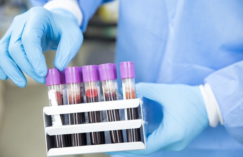 Covid, danni al sistema nervoso: studio dell’Università di Verona