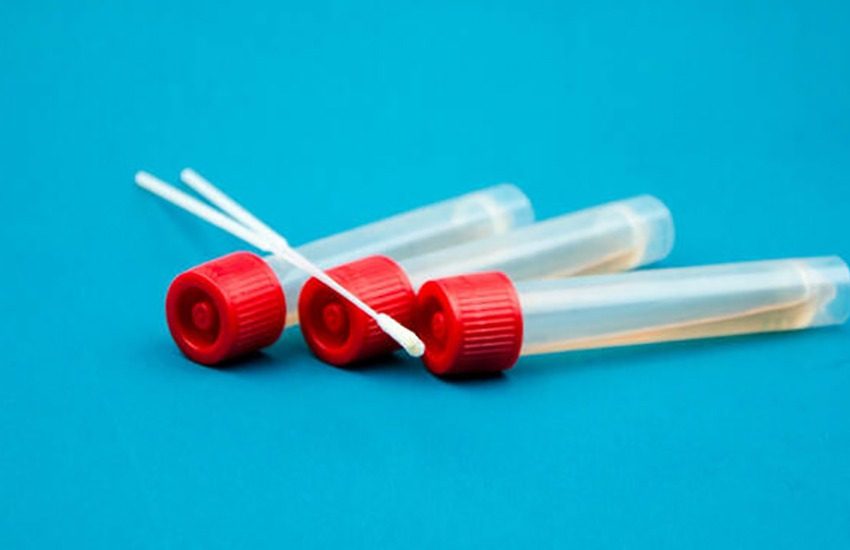 Coronavirus. I dati di oggi 17 luglio.”Preoccupa” la Lombardia