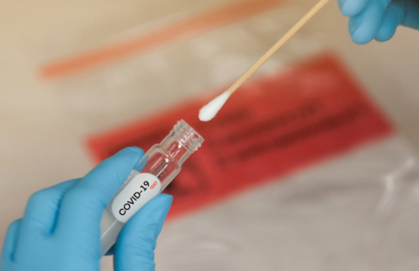 Coronavirus, ex Onpi: personale negativo a test rapidi sierologici