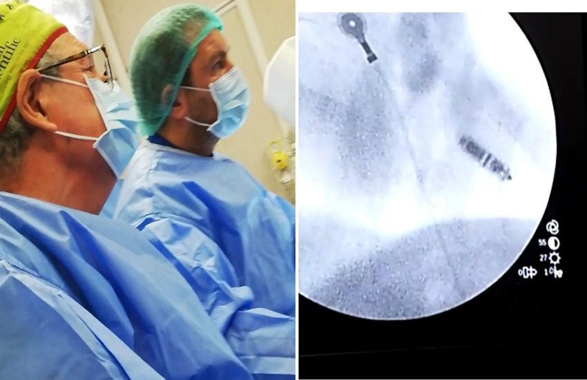 BELCOLLE: IMPIANTATA PRIMA CARDIOCAPSULA