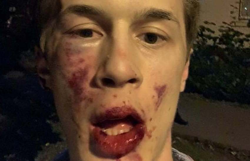 Russia, picchiato a sangue il popolare blogger e attivista, anti Putin, Zhukov