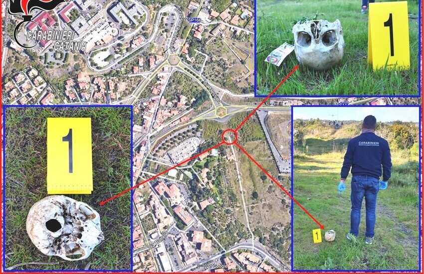 Catania, ritrovamento allarmante, rinvenuto teschio umano al Cannizzaro