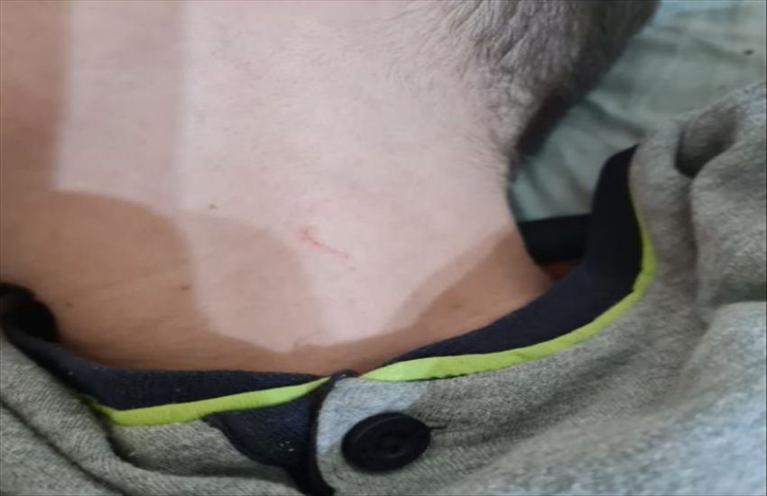 Vergogna a via Toledo: rapinata una 15enne con coltello alla gola per pochi euro