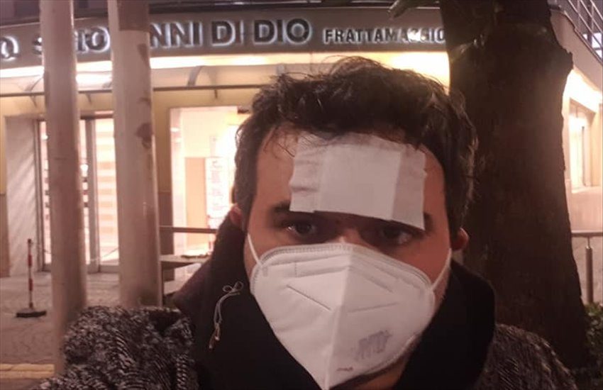 Professore aggredito a Casavatore, individuati i presunti aggressori: c’è anche il padre di un alunno