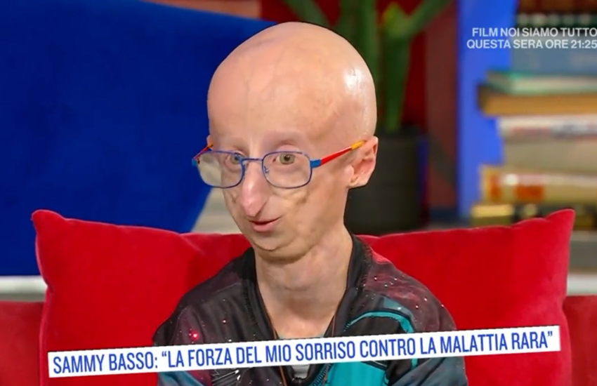 Sammy Basso emoziona con la sua lotta per sopravvivere alla progeria (VIDEO)