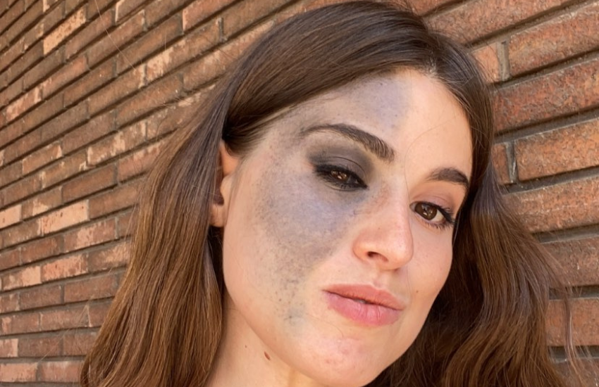 Carlotta Bertotti e la sua bellissima bellezza imperfetta: “Voglio essere felice” (VIDEO)