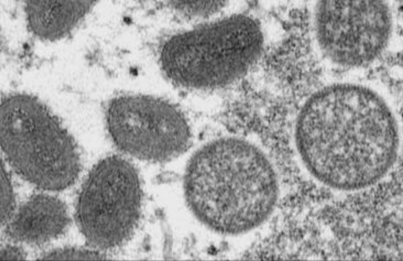 vaiolo delle scimmie