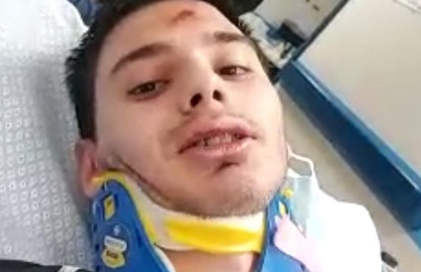 Giovane calciatore di Gaeta ferito dopo uno scontro di gioco: ricoverato in ospedale