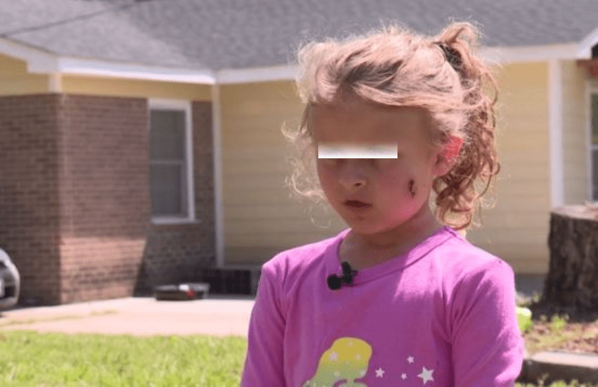 Padre e figlia di 6 anni feriti da colpi di fucile per un pallone: “Vi voglio uccidere”