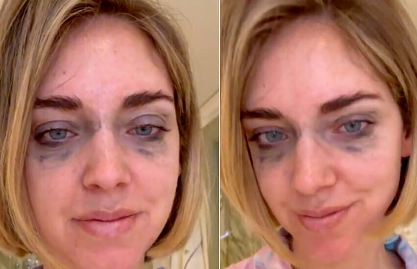 Chiara Ferragni colpisce ancora. Si mostra con occhiaie e trucco sbavato e conquista tutti