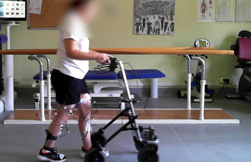 Milano: paralizzata da 5 anni, torna a camminare grazie a un innovativo intervento