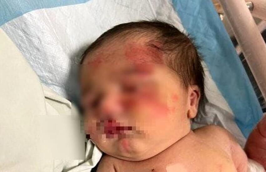 Miracolo: cane randagio salva una neonata abbandonata in un sacchetto di plastica