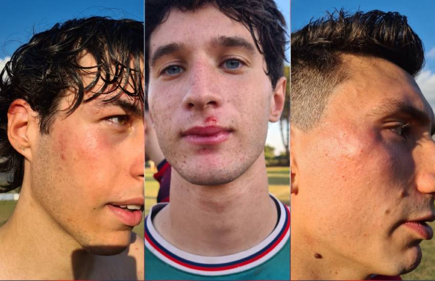 Giocatori aggrediti dopo Doganella – La Setina: pioggia di squalifiche