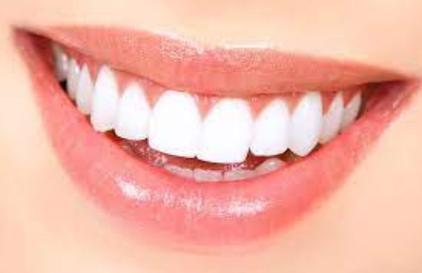 Come avere i denti bianchi: Ecco alcuni consigli per un sorriso perfetto