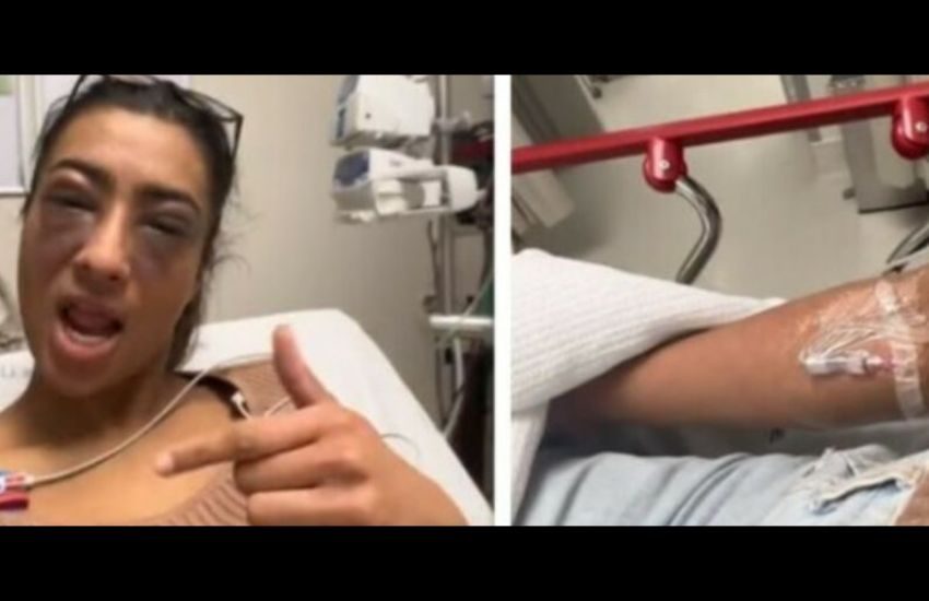 Allergica alle noccioline, tiktoker va in ospedale: “Ho rischiato di morire”, poi  filma tutto