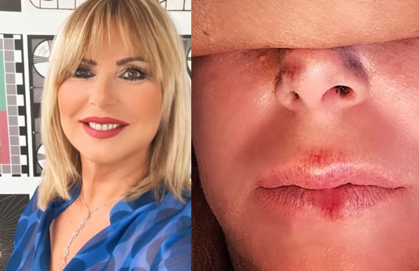 Brutto incidente per Monica Leofreddi: “Mi sento ferita, umiliata e spaventata”