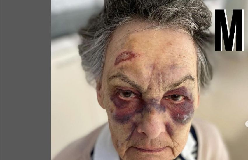 Choc a Milano, 83nne picchiata brutalmente da un senzatetto perché si rifiuta di dargli una monetina