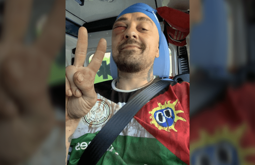 Chef Rubio col volto massacrato: “Questi sono gli ebrei sionisti”