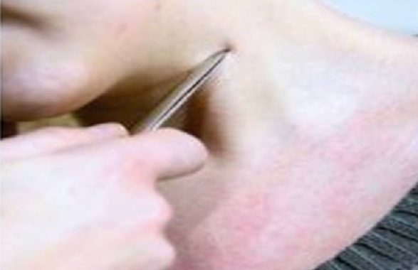 aggressioni in città